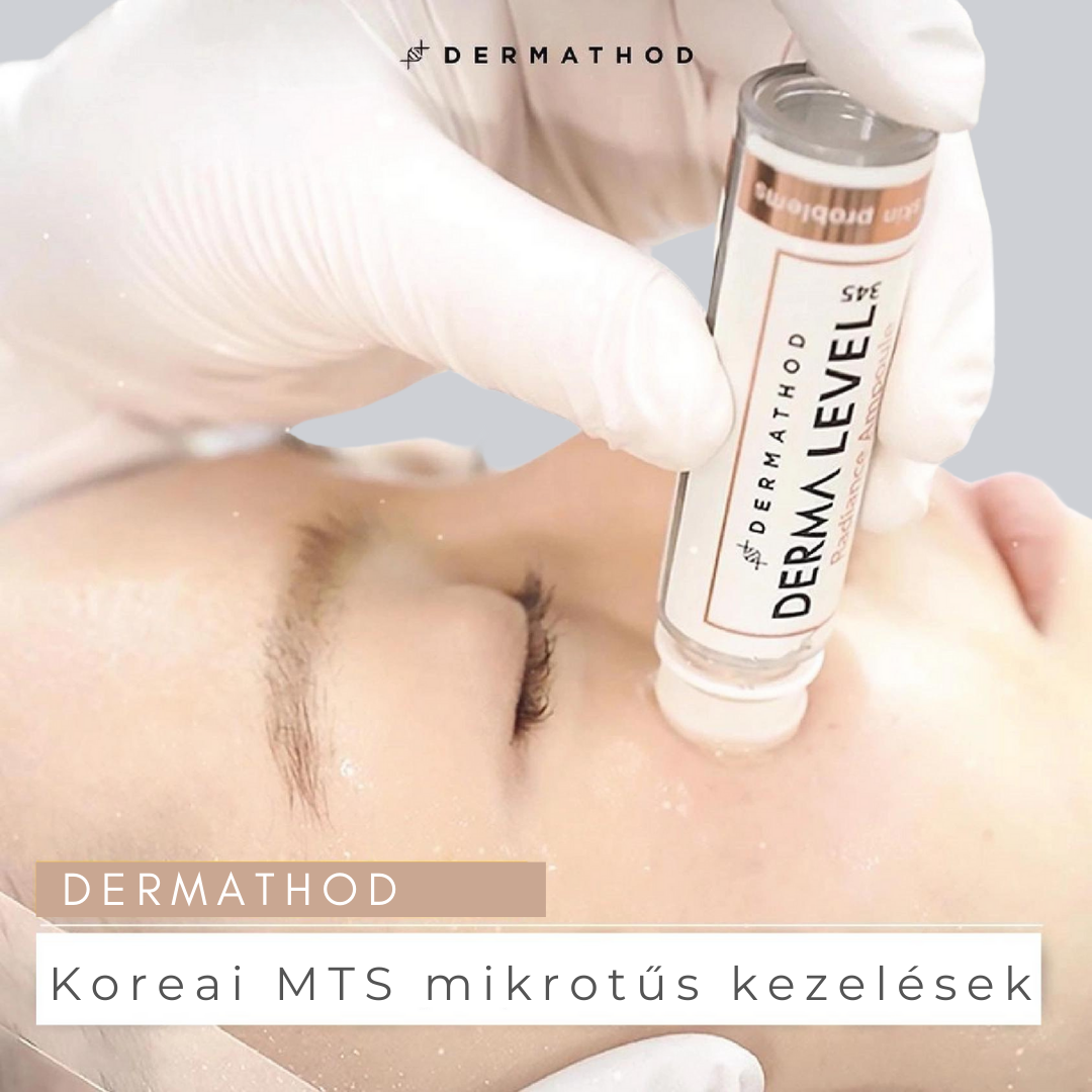 Radiance 345 ampulla integrált akril tűkkel