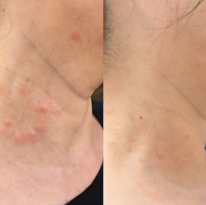 Azulene Cure Solution ampulla