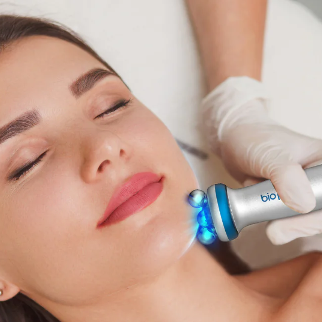 Bio Pen T6 Rádiófrekvenciás bőrfeszesítő készülék