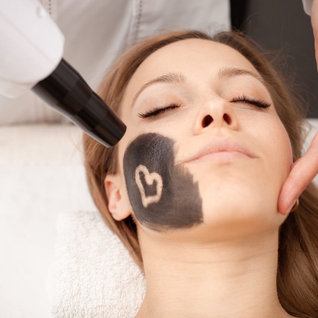 Carbon gél+1 db Anionos fátyolmaszk ajándék