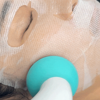 Dermathod Cooler masszírozó