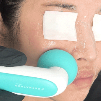 Dermathod Cooler masszírozó