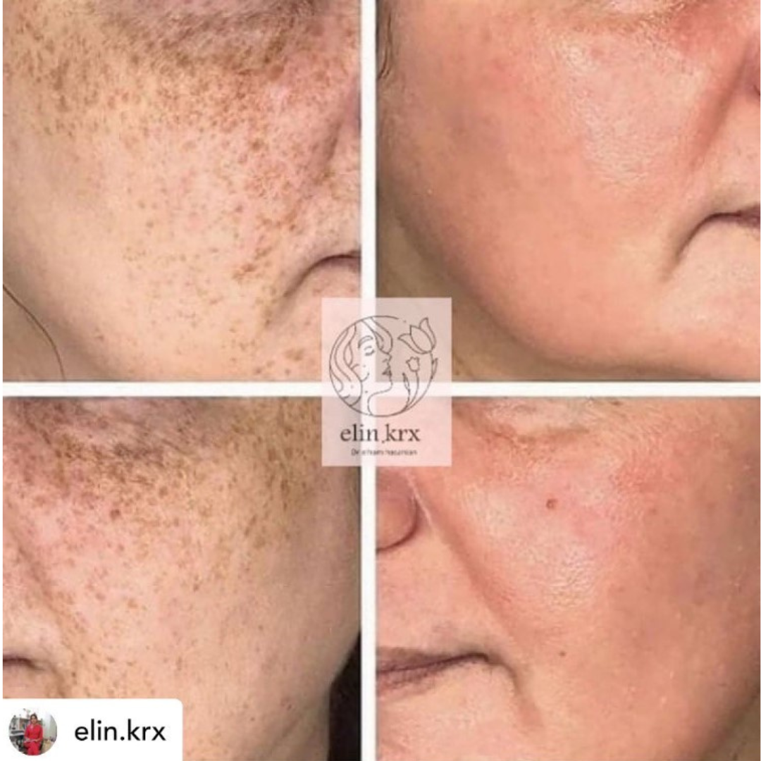 KRX Meso Booster White and Bright Ampulla 5ml