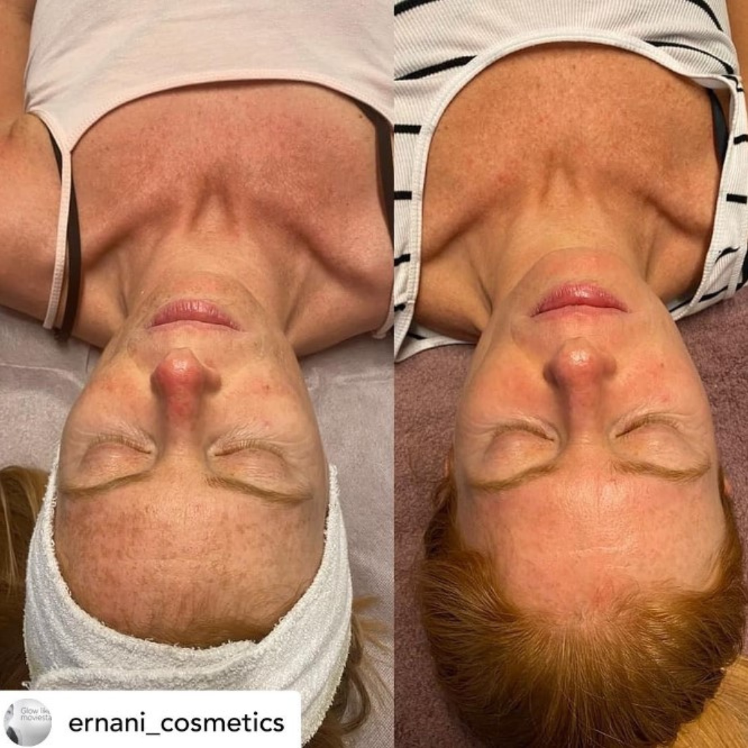 KRX Meso Booster White and Bright Ampulla 5ml