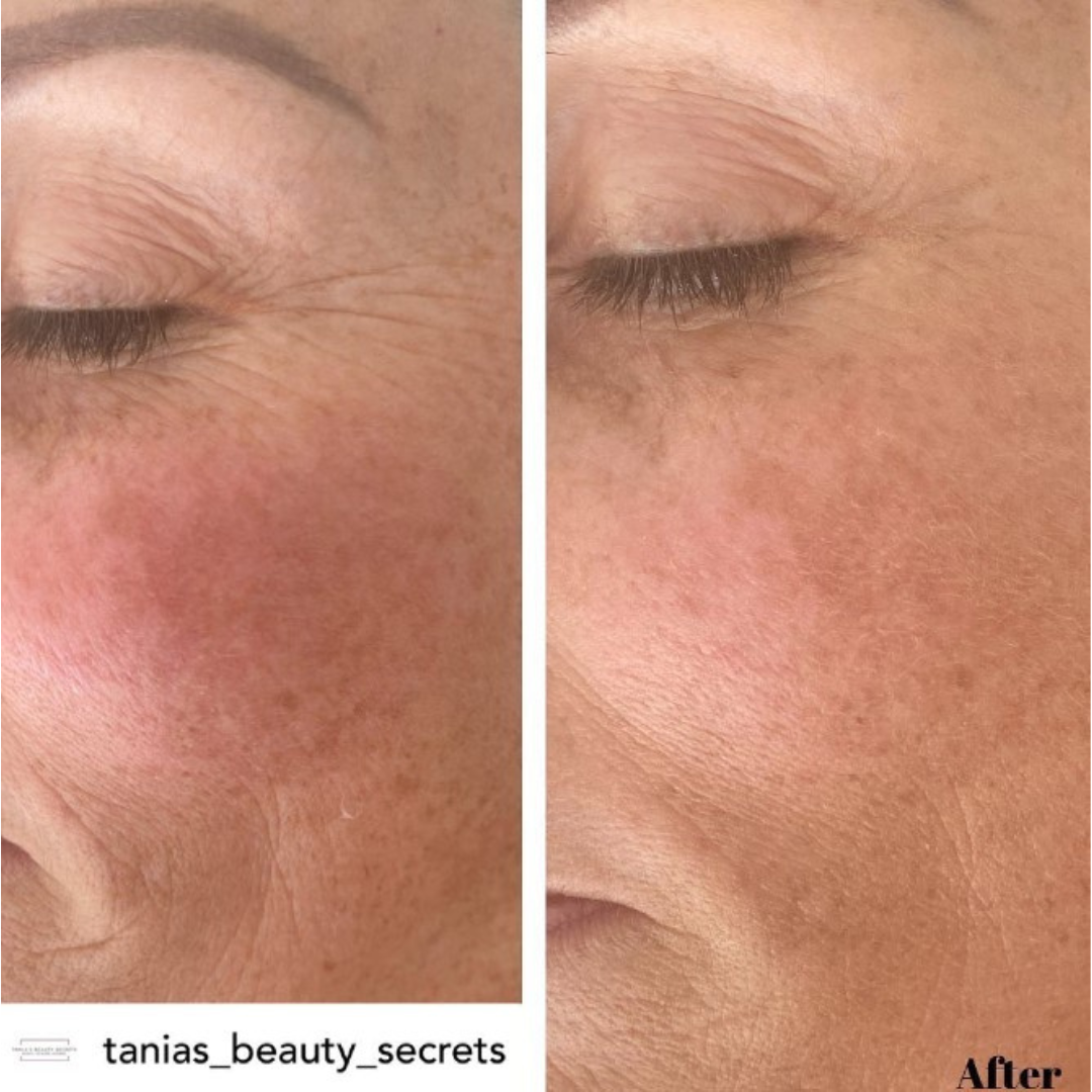 KRX Meso Booster Gold Peptide Ampulla 5ml