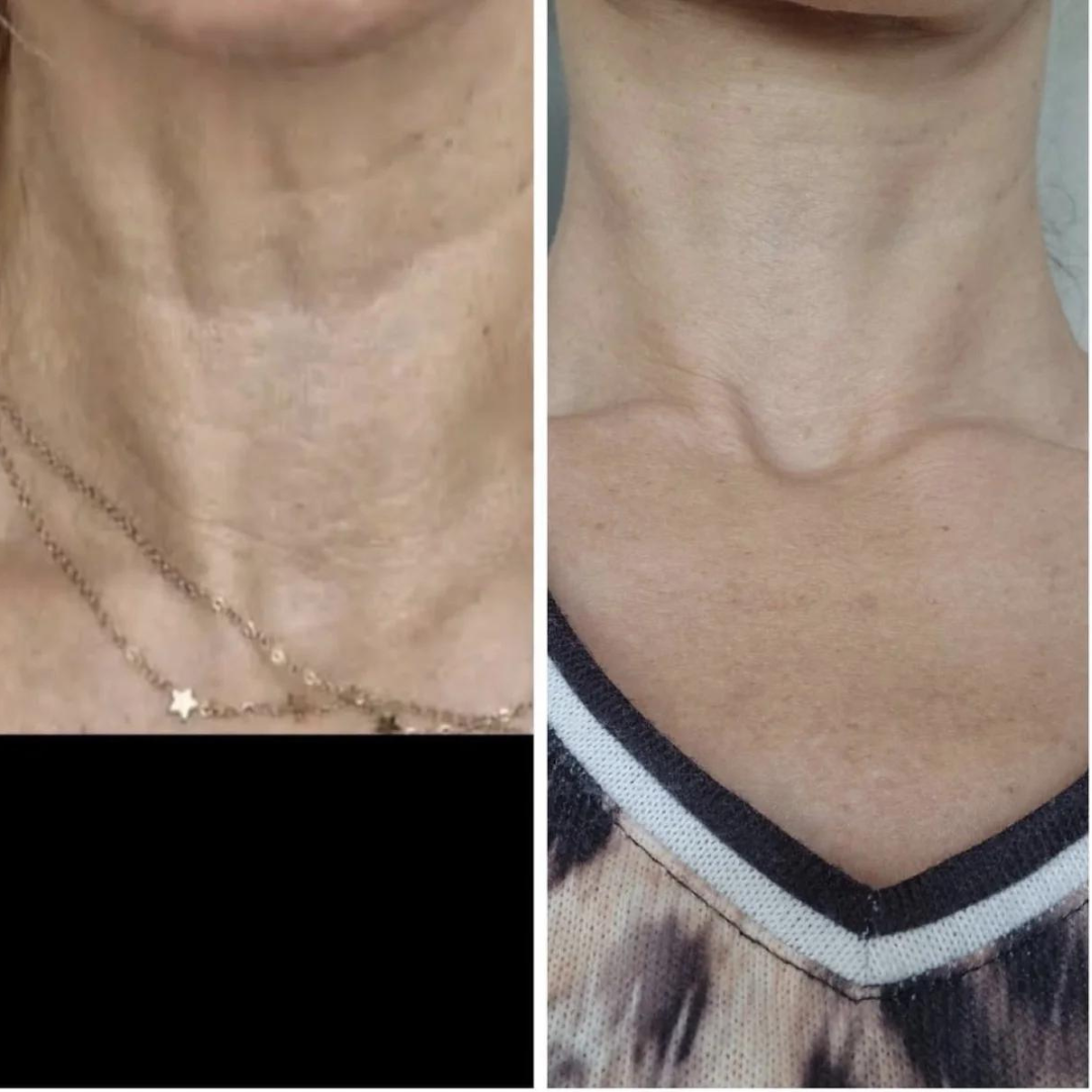 Kollagénes nyak és dekoltázs krém karácsonyi✨