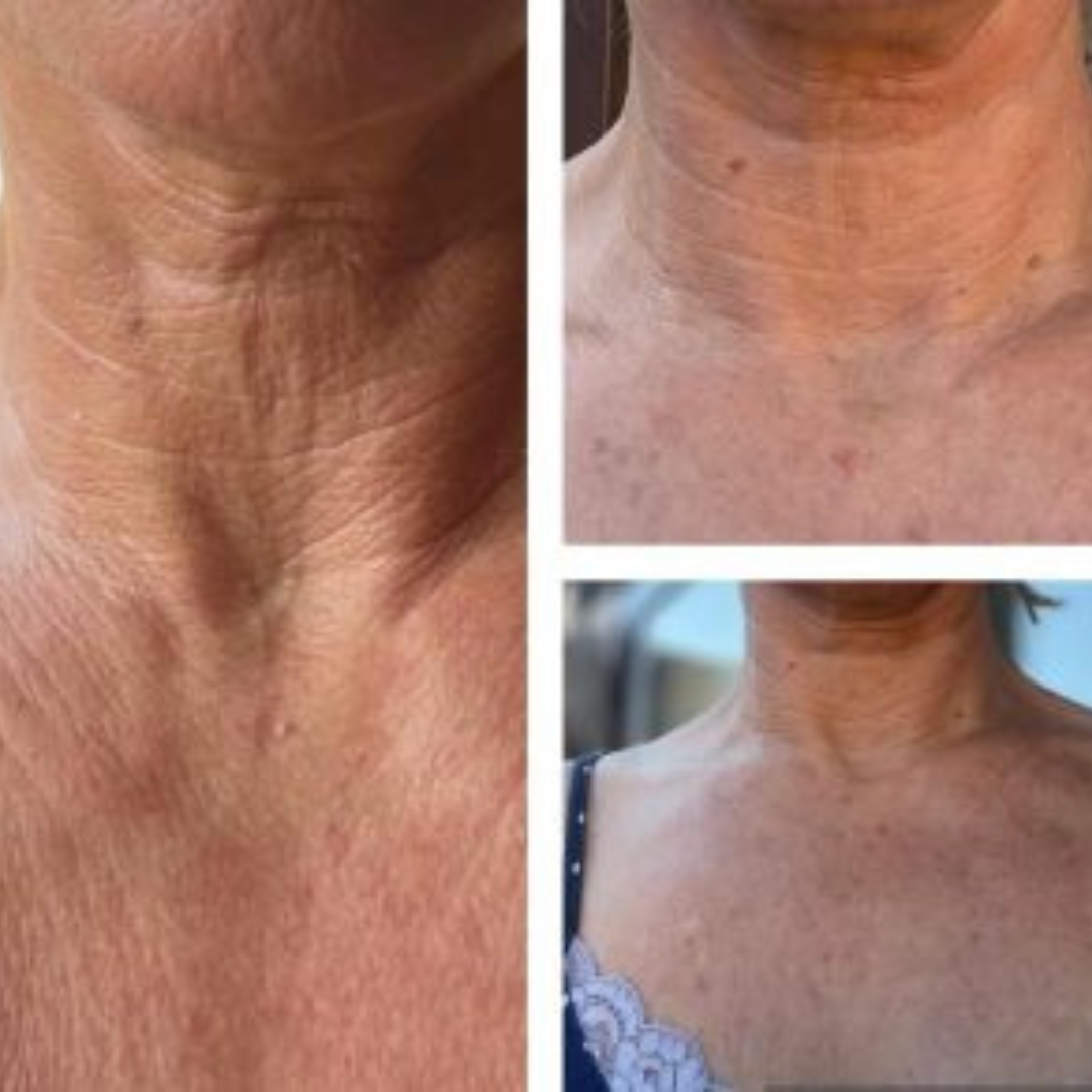 Kollagénes nyak és dekoltázs krém karácsonyi✨