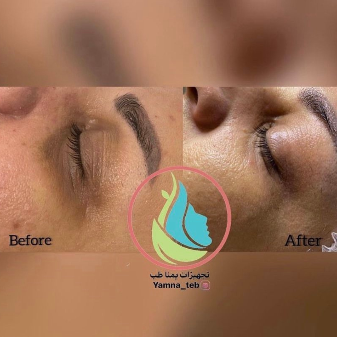 KRX Meso prémium Szemkörnyék ápoló szérum