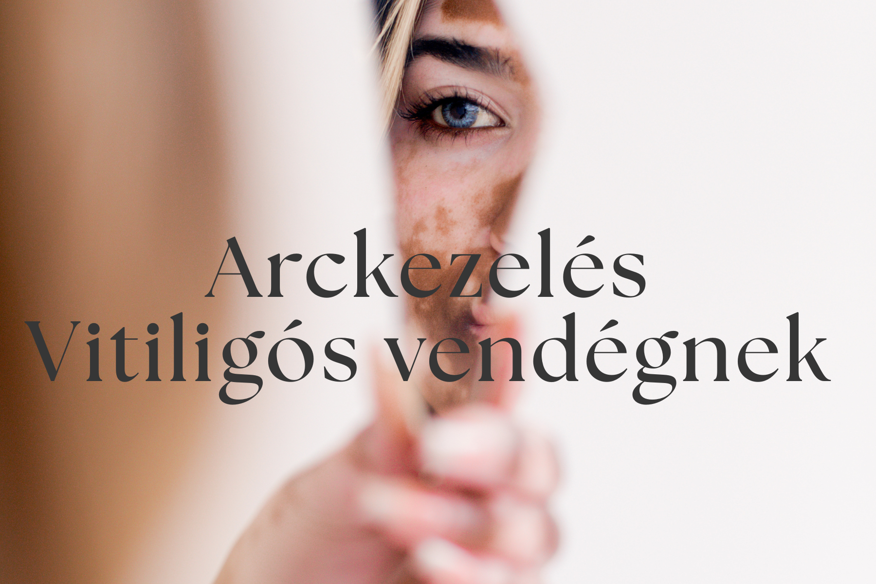 arckezeles vitiligo