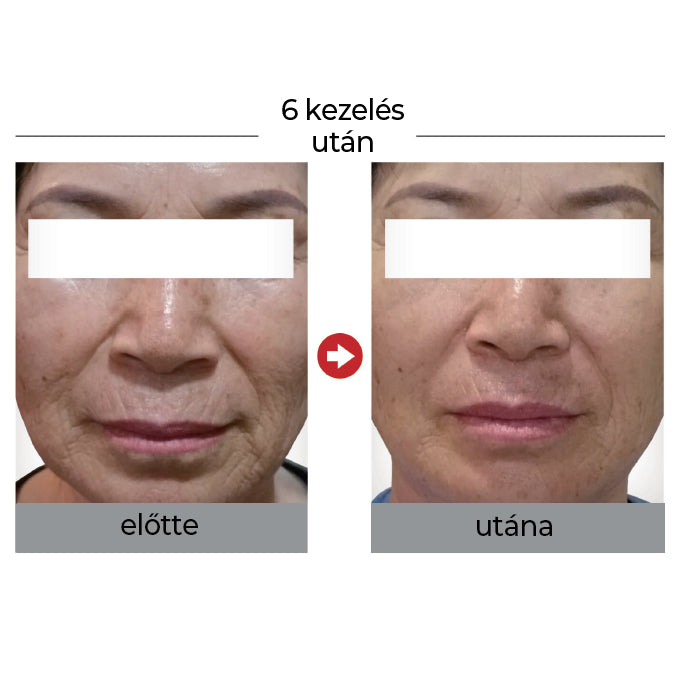 F.G.F. bőrfiatalító kezelő szett