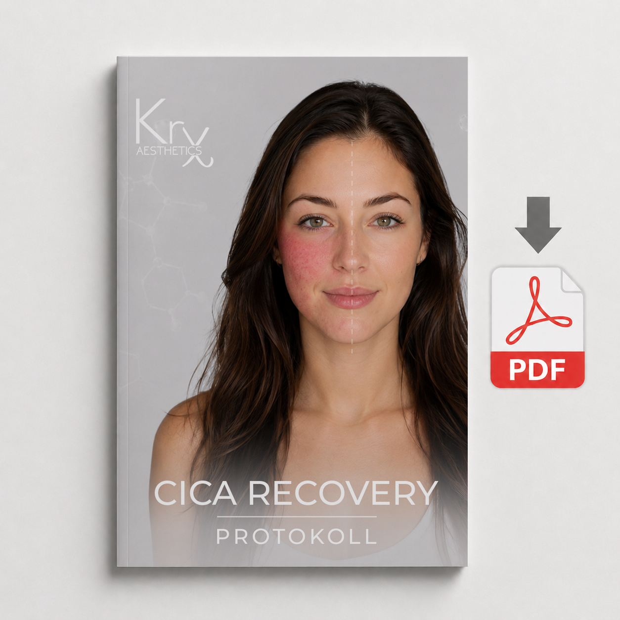 KRX CICA Recovery protokoll