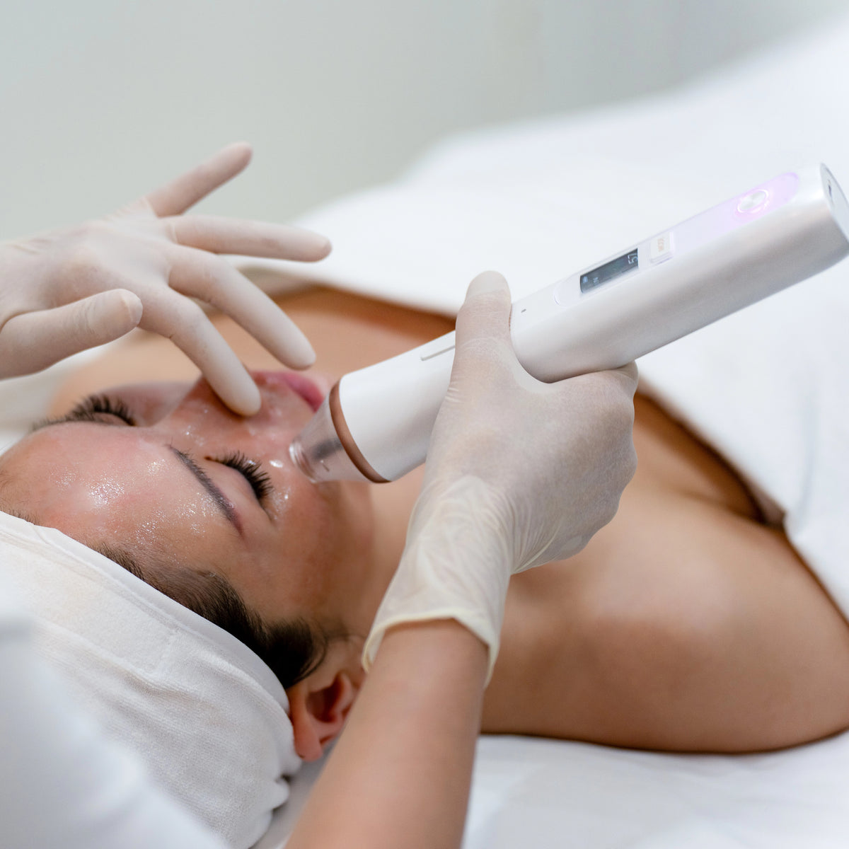 Szállítás alatt! Elérhető: Nov. 09. HiSONIC Cordless PLASMA – professzionális arcbőr- és fejbőrkezelő