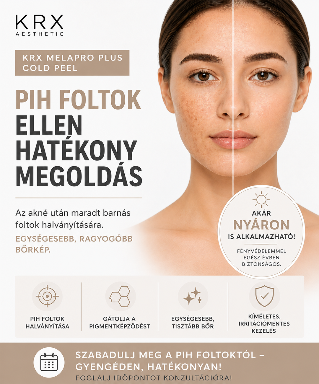 MelaPro Plus hideg peeling