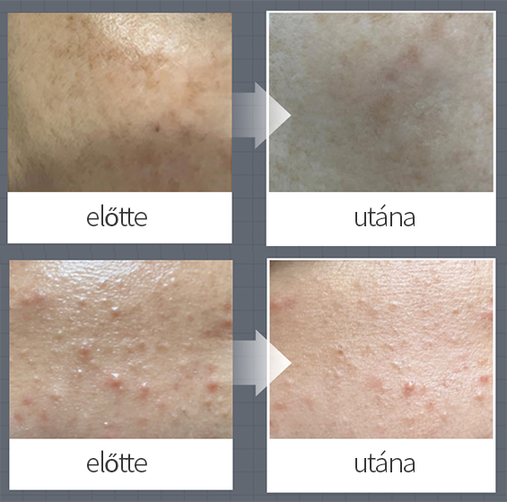 O2 Tox Peel